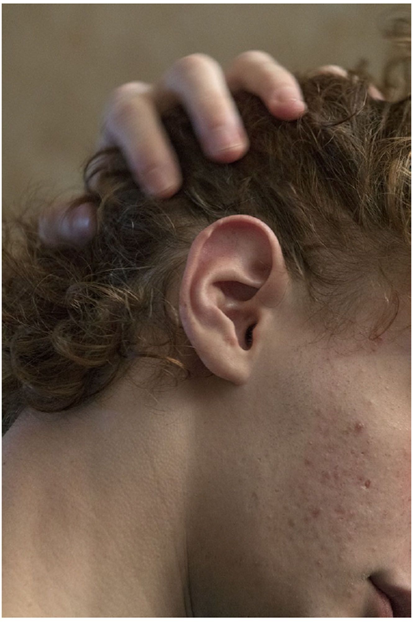 ICE AND FIRE: A BENEFIT EXHIBITION IN THREE PARTS | Danh Vō